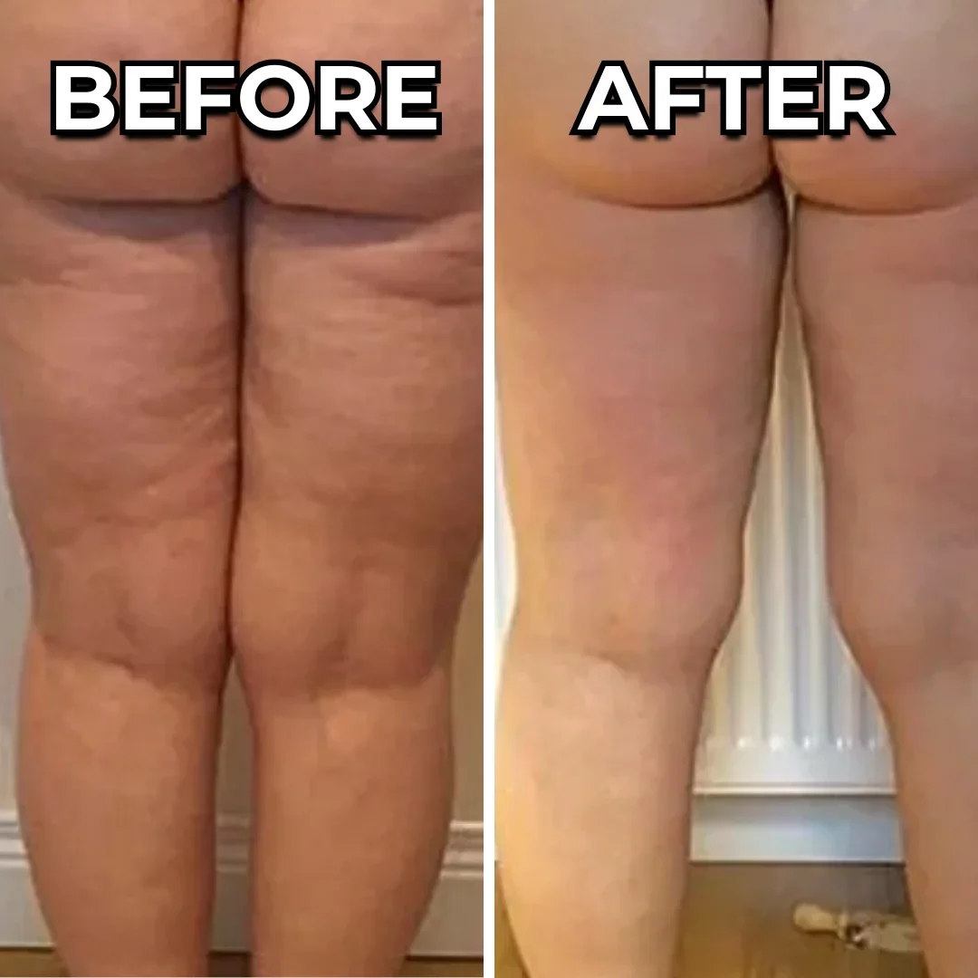 Another reader photo of thighs before and after